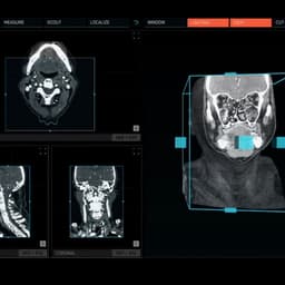 User Interface Design For A 3d Surgical Application cover image